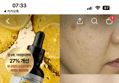79%할인 바이탈포션 슈퍼 글루타씨온 앰플, 18ml, 1개 (5,200원 / 배송 무료)